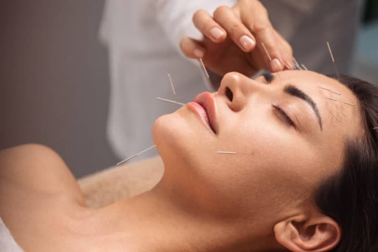 Acupuncture treatment