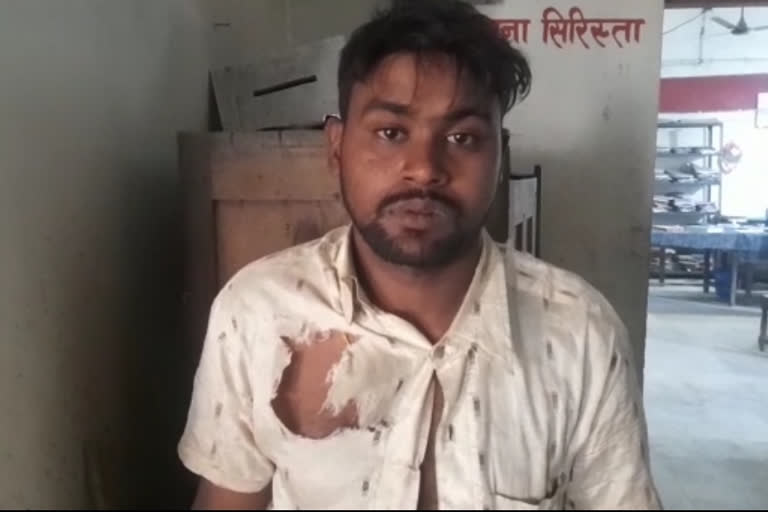 जहानाबाद में पति ने पत्नी को धारदार हथियार से काटा