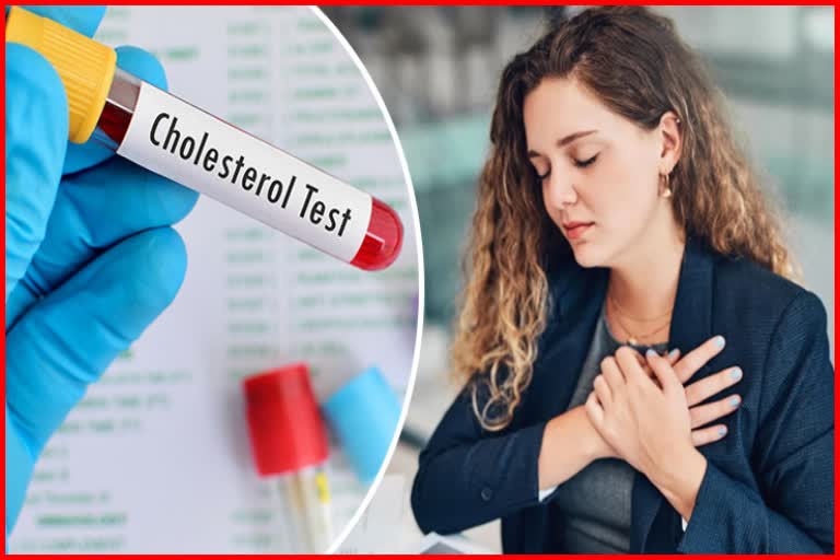 Cholesterol levels are strongly associated with heart attacks