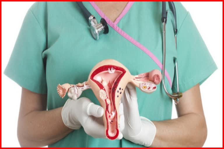 Increasing Trend of Hysterectomy in Indian Women