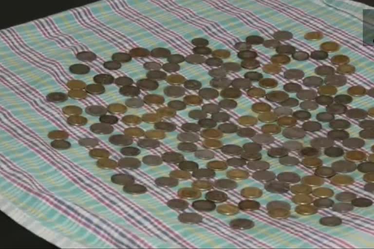 Karnataka Doctors at Hanagal Shree Kumareshwar Hospital say that they recovered 187 coins from body of a patientEtv Bharat