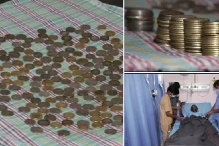 doctors-removed-187-coins-from-patients-body-in-bagalkot-karnataka