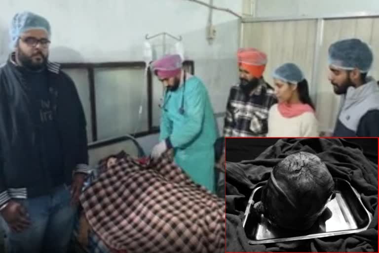 Doctors at Baba Farid Charitable Hospital in Amritsar removed a tumor weighing more than 3 kg from a woman stomach