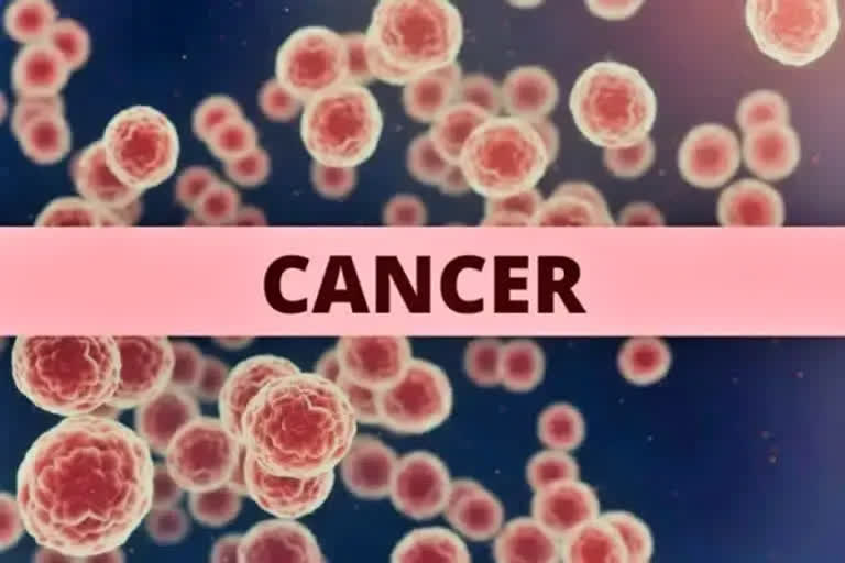 Colon Cancer  Cancer  Colon Cancer treatment  Pele diagnosed with Colon Cancer  Abdominal Pain  Weight Loss  Colon Cancer symptoms and causes  Colon Cancer symptoms  വന്‍കുടല്‍ കാന്‍സറിനുള്ള കാരണങ്ങളും ലക്ഷണങ്ങളും  വന്‍കുടല്‍ കാന്‍സര്‍  ഡോ ദിഗ്‌പാൽ ധർകര്‍  ഇൻഡോർ കാൻസർ ഫൗണ്ടേഷന്‍  Red Meat  കാൻസർ സങ്കേത്  ട്യൂമർ മാർക്കർ  saturated food  കാർസിനോംബ്രിയോണിക് ആന്‍റിജൻ  സോണോഗ്രാഫി  കൊളോനോസ്‌കോപ്പി  വന്‍കുടല്‍ കാന്‍സറിന്‍റെ കാരണങ്ങളും ലക്ഷണങ്ങളും