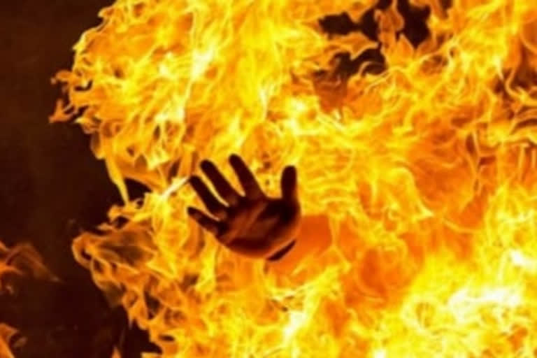 Wife burns husband due to domestic dispute in Jharkhand's Chatra