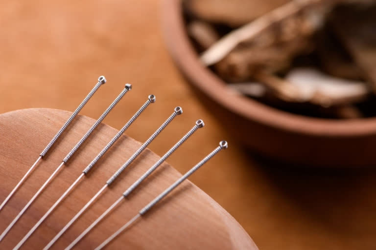 How acupuncture works