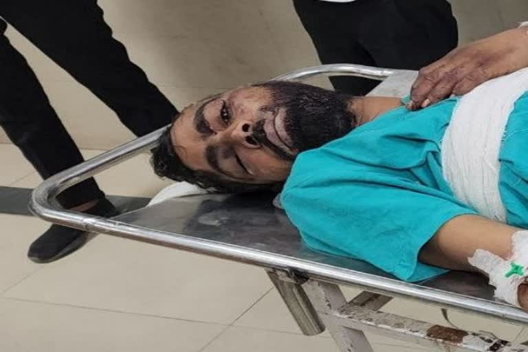 Dalit Man Brutally Beaten in Jalore