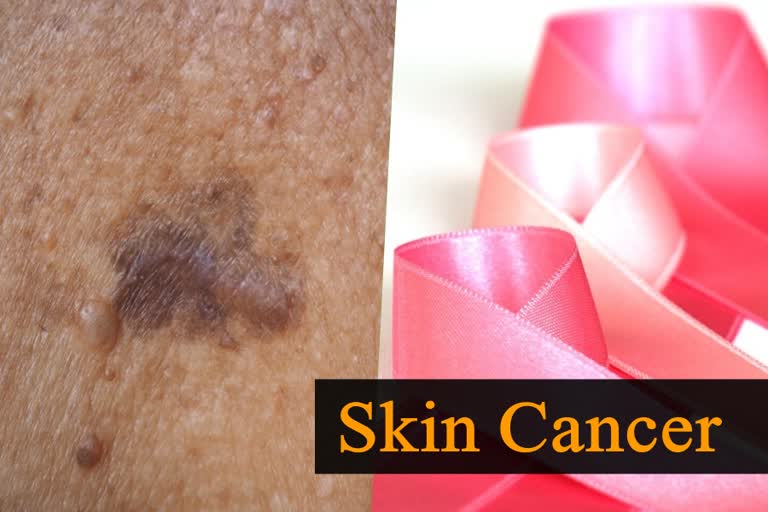 Skin Cancer Myths and Facts