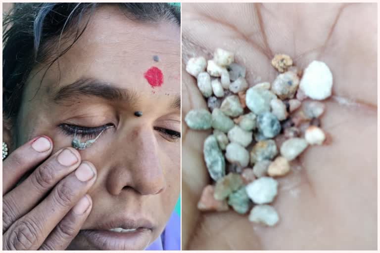 Stones falling from a woman eye