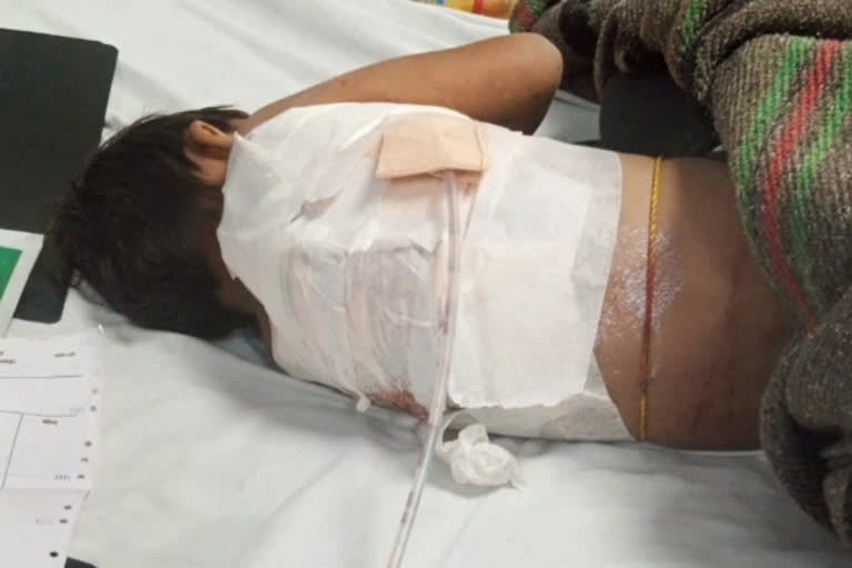 Stray dog injured girl in Jaipur