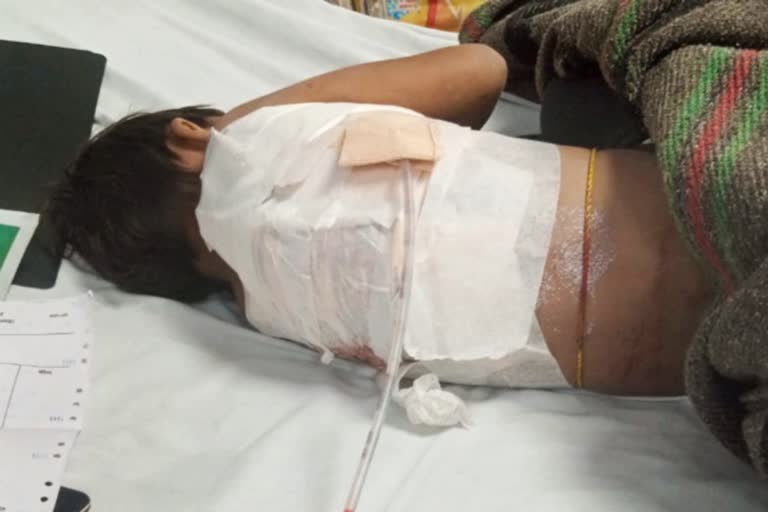 Stray dog bite girl in Jaipur