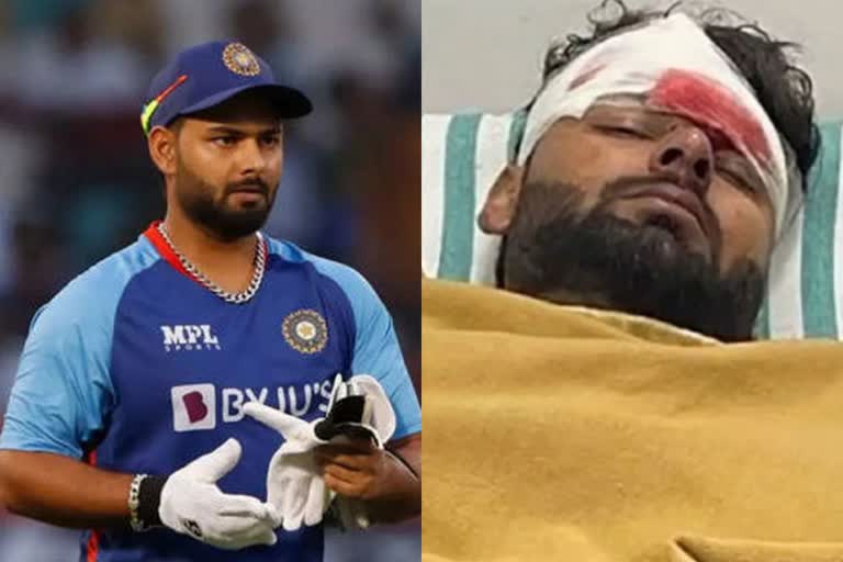 Rishab Pant Plastic Surgery