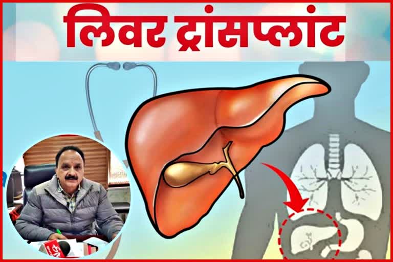 Dr RK Agnihotri on Liver Transplant.