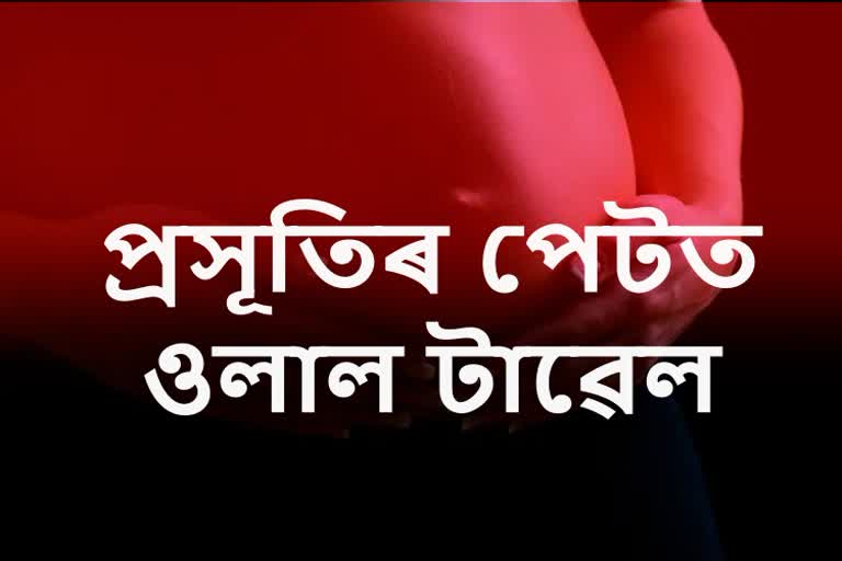 প্ৰসূতিৰ পেটতে চিকিৎসকে এৰিলে টাৱেল