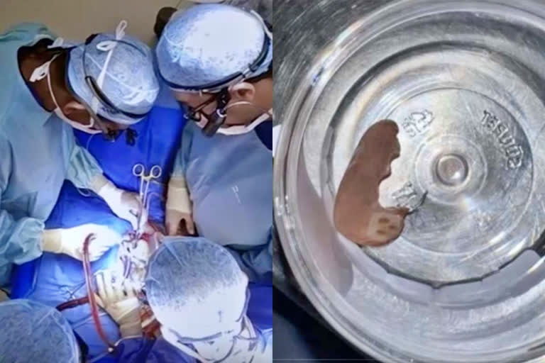 Denture stuck in chest removed after 4 hour long surgery