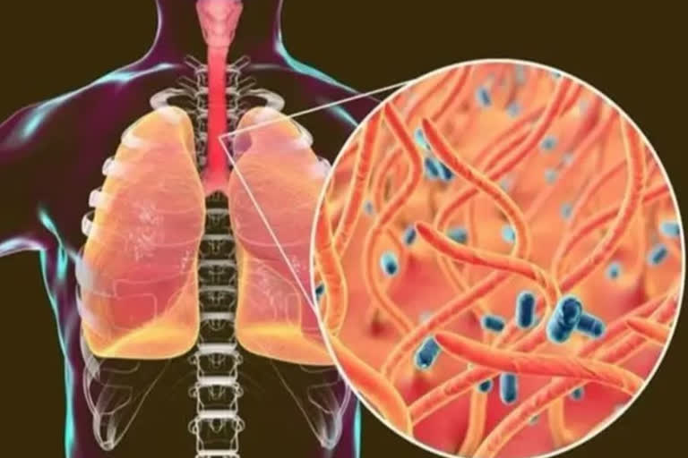 مغربی بنگال میں کالی گھاسی میں مبتلا مریضوں کی تعداد میں اضافہ