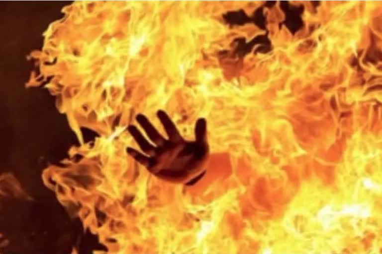 MISCREANTS SET FIRE TO MINOR GIRL IN VAISHALI FOR REFUSING TO DANCE