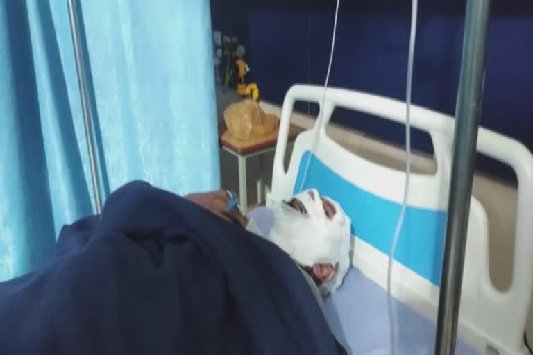 China door fell on man's face, seriously injured