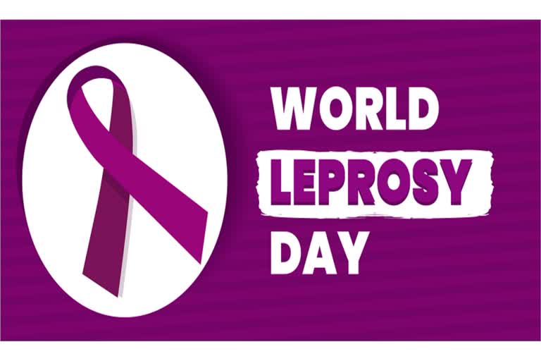 International Leprosy Day: રક્તપિત્ત માત્ર એક કલંક નથી પરંતુ એક રોગ છે