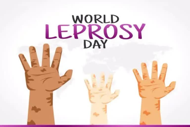 World Leprosy Day