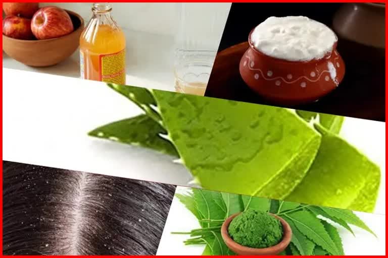 Home Remedies For Dandruff