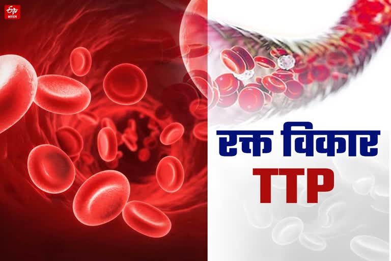 blood disorder ttp thrombotic thrombocytopenic purpura platelets count in blood problems