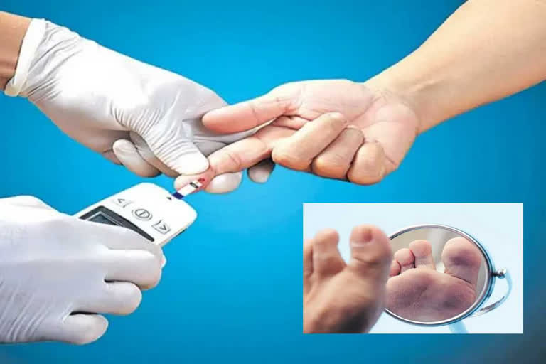 Diabetes cases are increasing in AP