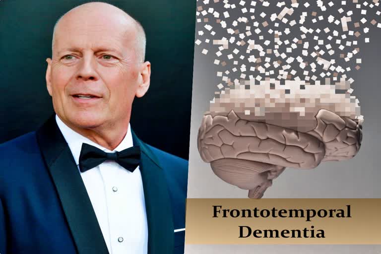 What is dementia The condition Die Hard star Bruce Willis is diagnosed with