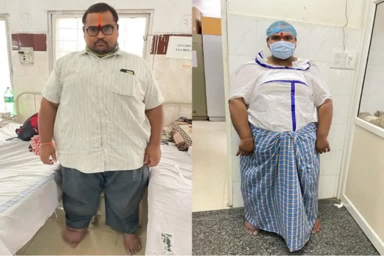 Doctors perform bariatric surgery on super obese patient weighing 240 kg  ബരിയാട്രിക് സര്‍ജറി  അമിതാഭാരത്താല്‍  ഒസ്‌മാനിയ ആശുപത്രി  Osmania Hospital  bariatric surgery done in Osmania Hospital  ഒസ്‌മാനിയ ആശുപത്രി ബരിയാട്രിക് സര്‍ജറി  ബരിയാട്രിക് സര്‍ജറി എന്താണ്  what is bariatric surgery