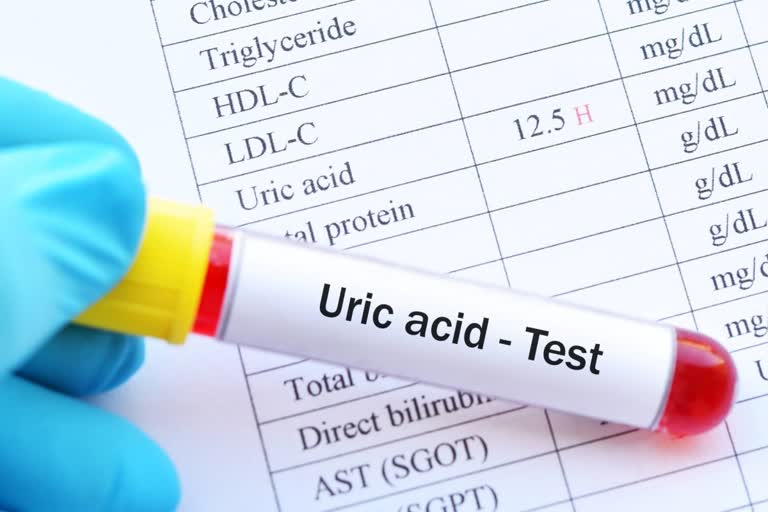 High Uric acid test kit