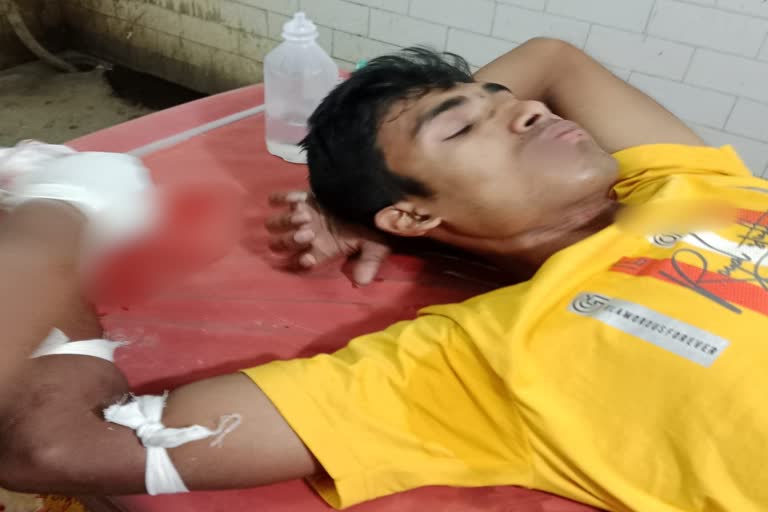 Student Injured by Bomb Blast