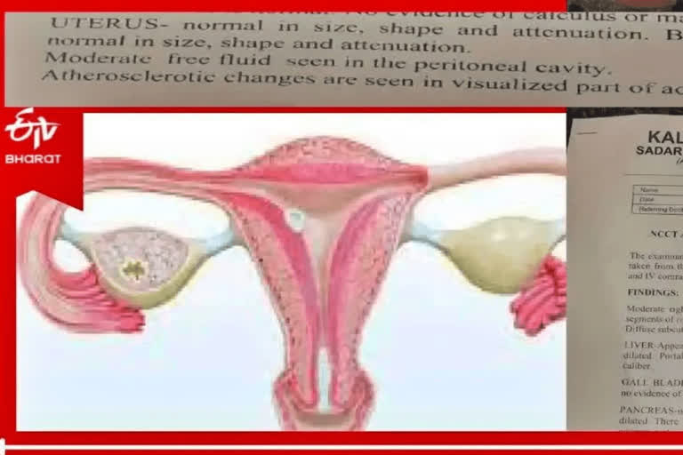 a-60-year-old-man-found-a-uterus-this-is-not-a-surprise-of-the-medical-world-but-a-mistake