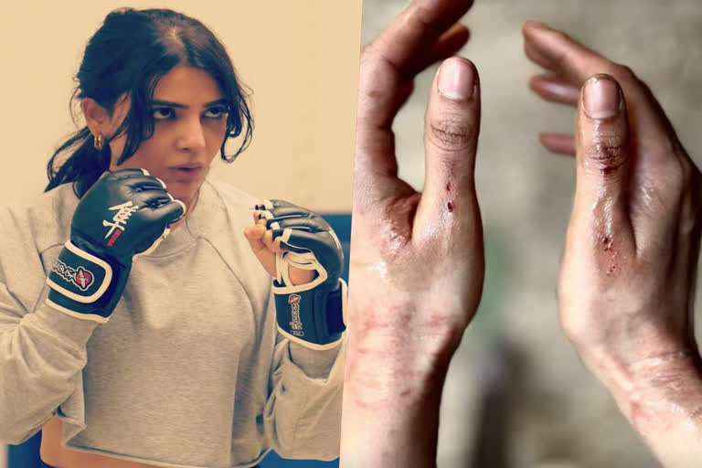 Samantha shares pictures of bruised and battered hands as she shoots for Citadel