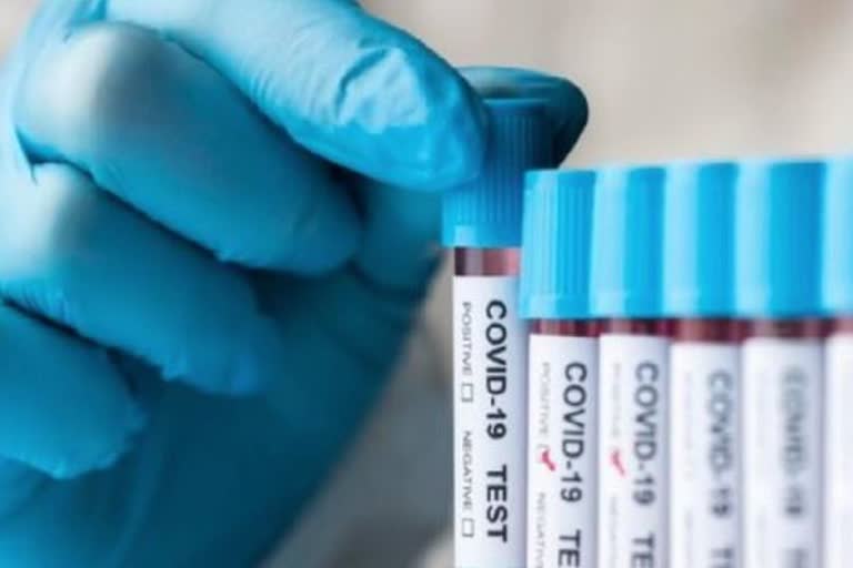 Coronavirus Update, Corona Positive Case