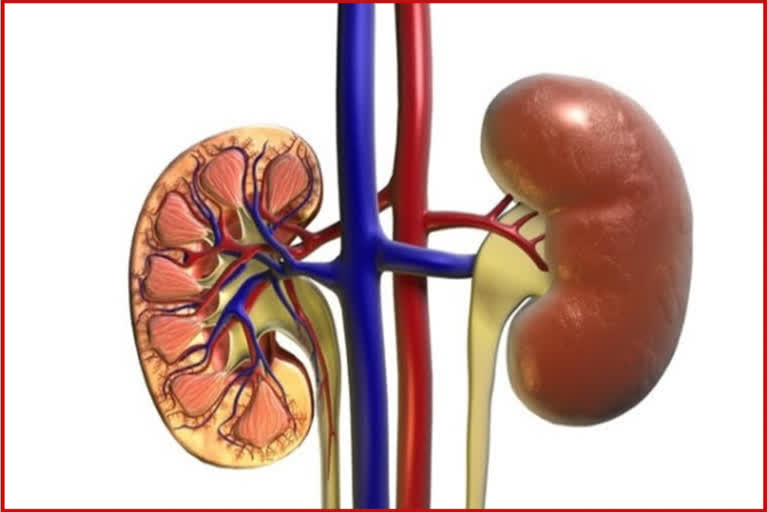 World Kidney Day 2023