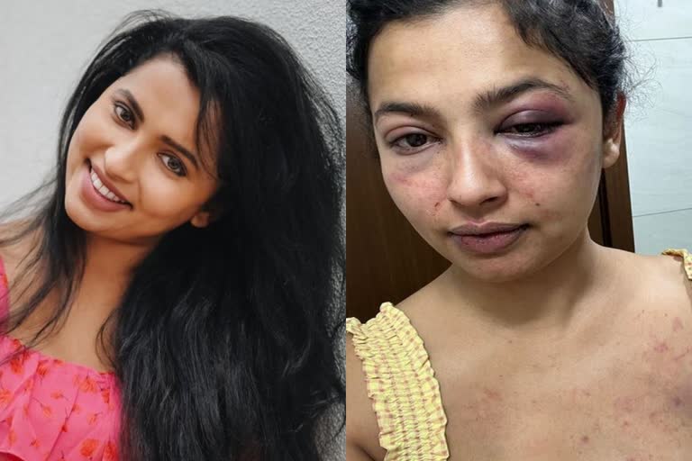 Tamil actress Anicka Vijayi Vikramman Attack