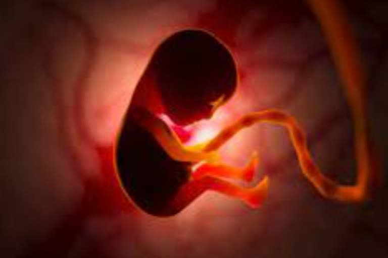 Unborn Twin Found Inside Baby Brain