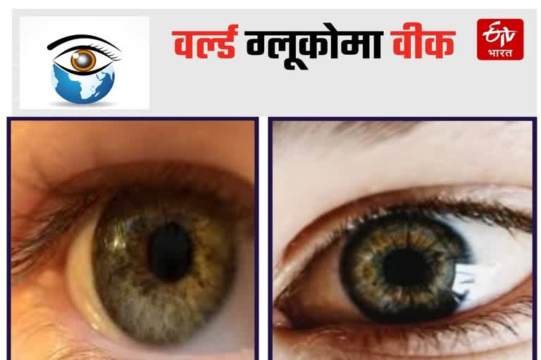 World Glaucoma Week