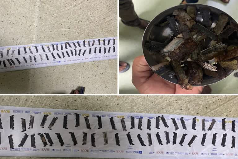 unique-surgery-of-young-man-doctors-removed-56-blades-in-young-man-stomach