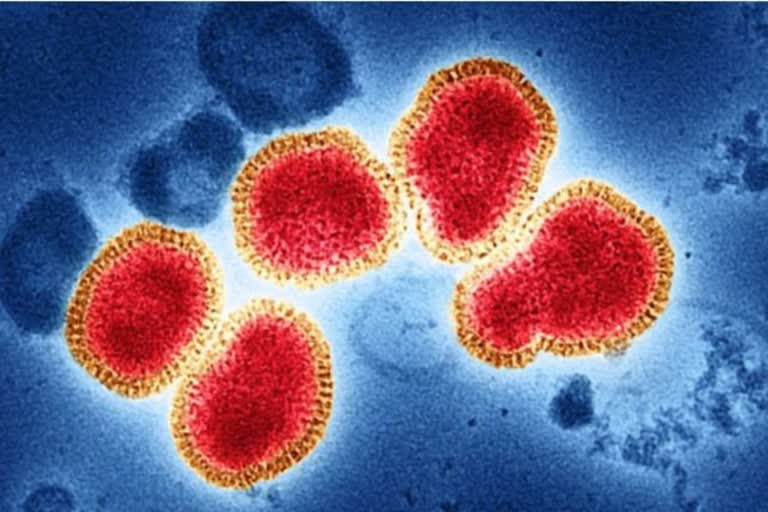 H3N2 cases in Ahmedabad  અમદાવાદમાં H3N2 વાયરસ કેસ 4 પર પહોંચ્યાં, 2 દર્દી હોસ્પિટલમાં સારવાર હેઠળ
