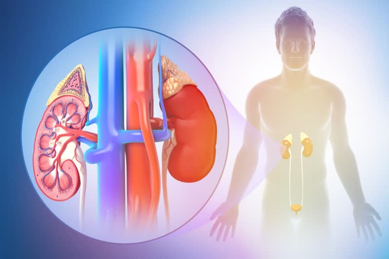 Nephrotic Syndrome