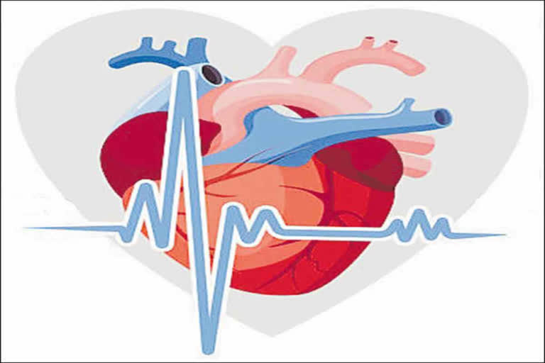 Stemi Project For Heart Attack Deaths Controle