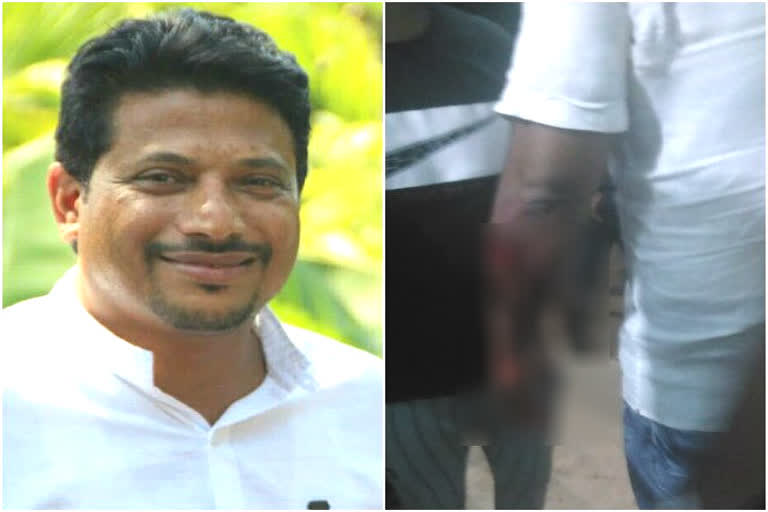 Unknown person attack on gram panchayat president