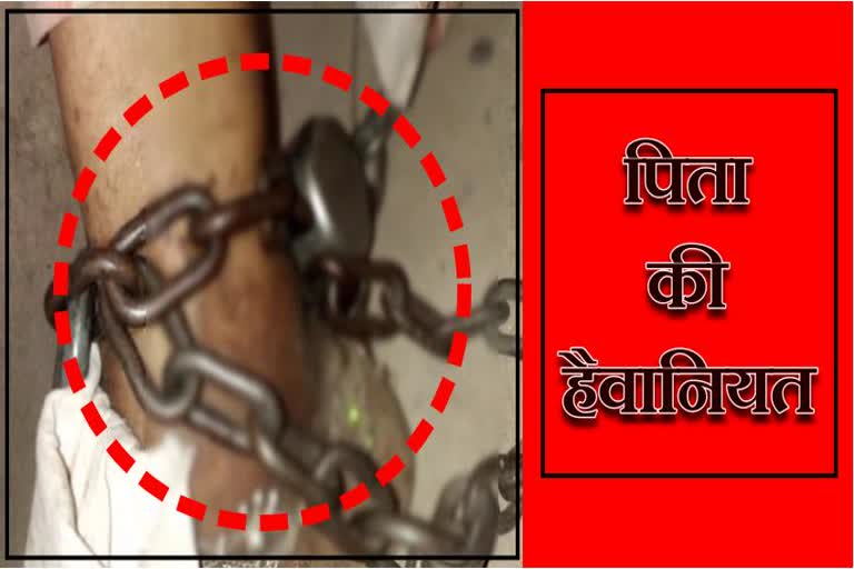 father tied daughter by chain in jalore, jalore news, जालोर में बेटी को जंजीर से बांधने की खबर