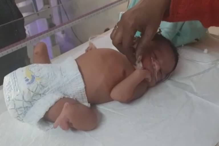 handicapped new born baby in amritsar