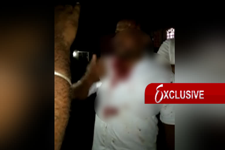 Assaulting JDS activist by Suraj Revanna, ಸೂರಜ್​ ರೇವಣ್ಣ, ಬೆಂಬಲಿಗರಿಂದ ಹಲ್ಲೆ ಆರೋಪ