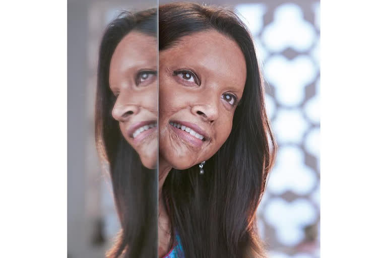 Chhapaak Trailer drops tomorrow, Chhapaak, Chhapaak news, Chhapaak updates, deepika padukone, deepika padukone news