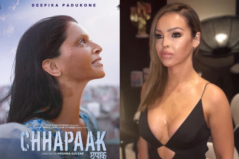 English activist Katie Piper, Katie Piper praises Chhapaak, Chhapaak trailer, Deepika Padukone's upcoming film Chhapaak, English activist Katie Piper praises Deepika's film, इंग्लिश एक्टिविस्ट केटी पाइपर, केटी पाइपर प्रशंसा छपाक, छपाक ट्रेलर, दीपिका पादुकोण छपाक ट्रेलर