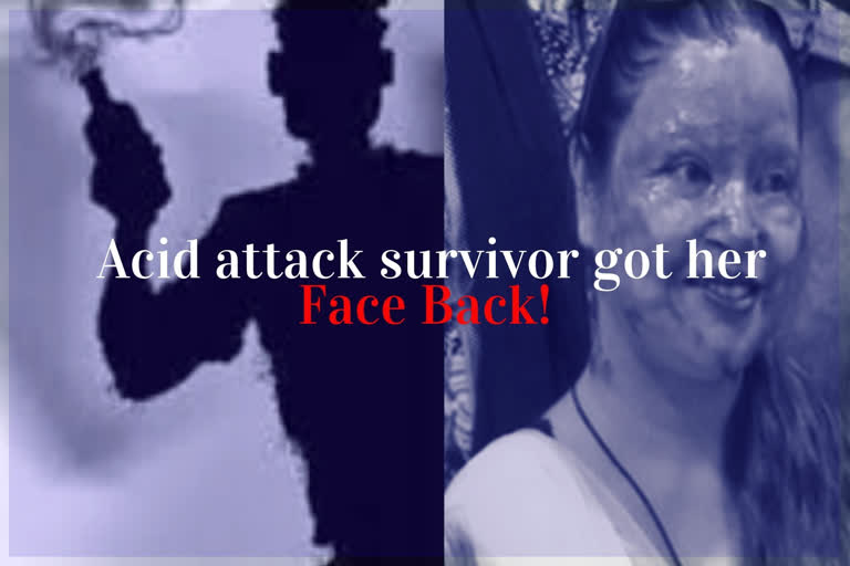 acid attack