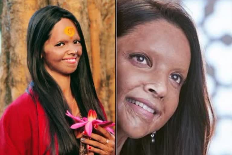 LAXMI AGARWAL